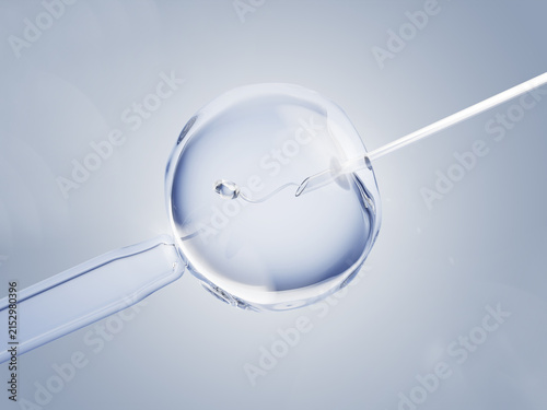 Canvastavla In vitro fertilisation IVF for pregnancy