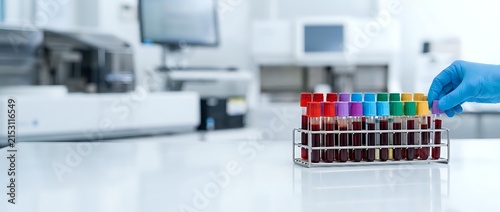 Scientist in blue glove holding test tube rack with colorful blood samples in modern laboratory setting with medical equipment in background.