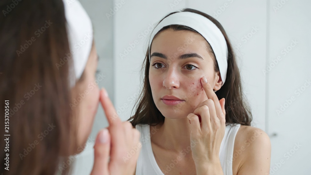 Fototapeta premium Young woman looking in mirror and touching acne on her cheek