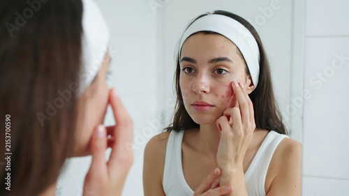 Young woman looking at acne on her cheek in a bathroom mirror