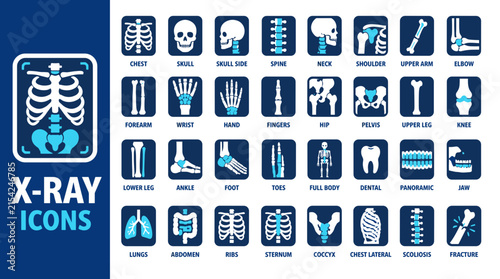 X ray imaging bones skeleton chest skull hand finger pelvis rib spine.