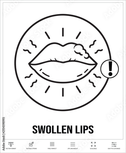 Swollen Lips