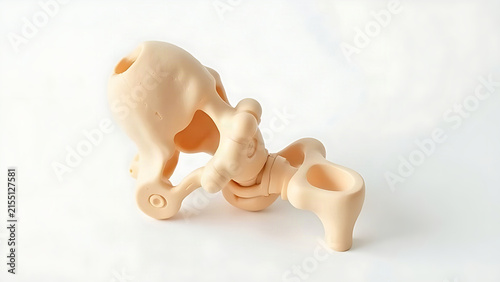 Anatomical shoulder model with humerus misalignment on white surface, joint injury concept
