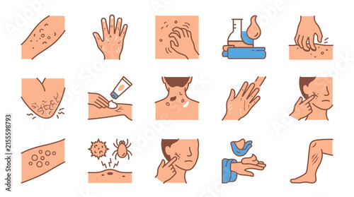 Skin conditions and treatments illustrated set