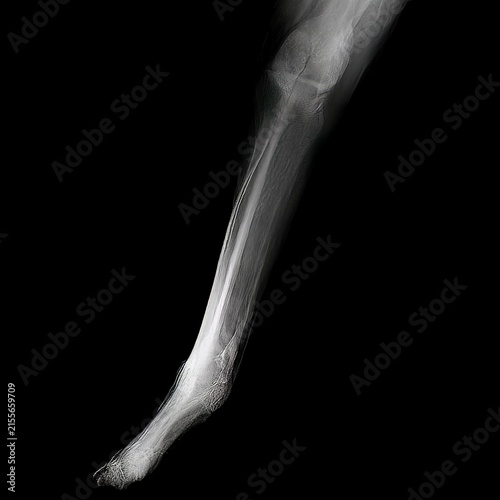 Obraz na płótnie Dog leg appears in this x-ray image.
