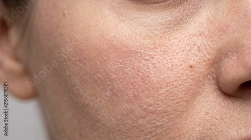 Close up of human skin with visible pores and texture.