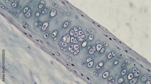 Microscopic view of hyaline cartilage tissue showing chondrocytes in lacunae.