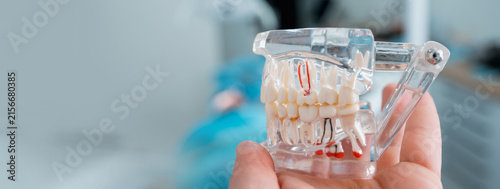 Model of human jaw teeth in a dental office with a blurred patient in the chair in the background banner copy space