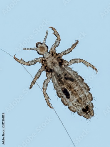 Microscopic view of a head louse isolated on a blue background. Detailed anatomy of human pediculosis parasite. Scientific laboratory research