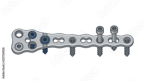 Orthopedic Bone Plate and Screws Isolated