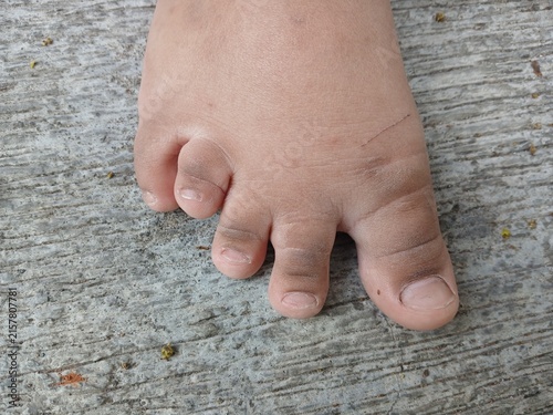 Foto Close-up View of Child's Toes