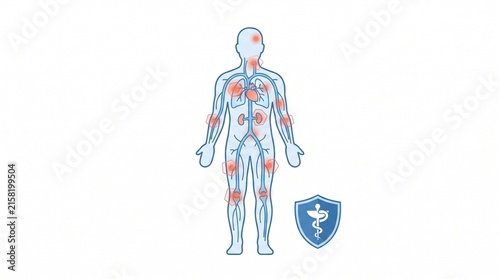 Clipart Representing Sepsis and Systemic Infection Awareness