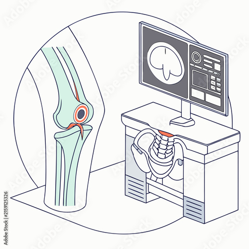 Medical joint scan examination knee orthopedic x ray concept with examination