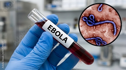  Laboratory gloved hand holding Ebola virus blood sample tube for infectious disease research