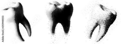 Set of Three Halftone Dotted Human Molar Tooth Illustrations in Black and White Retro Style