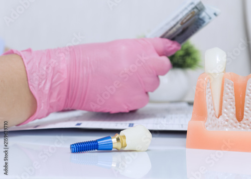 Payment for expensive dental services and prosthetics illustrated by a macro tooth implant and a doctor holding money over medical paperwork.