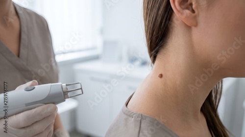 Woman receiving laser mole removal treatment on neck from dermatologist. Professional skincare procedure for benign skin lesion elimination and aesthetic medical care in clinic.
