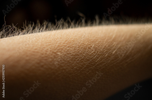 Cuadro en lienzo Detailed macro close-up of goosebumps on human skin, with fine body hair standing on end