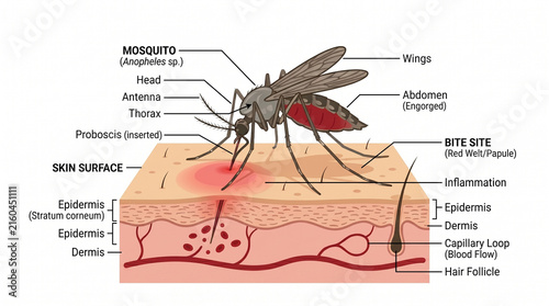 Educational Diagram of Mosquito Biting Human Skin with Labeled Anatomy