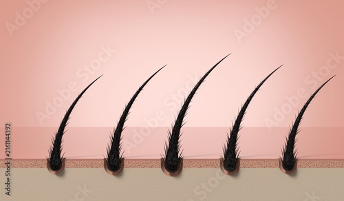 Row of multiple damaged weak hair strands growing on scalp - 3d illustration