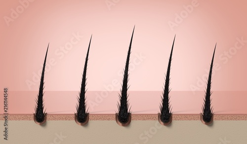 Multiple damaged hair strands with split ends on skin - 3d illustration
