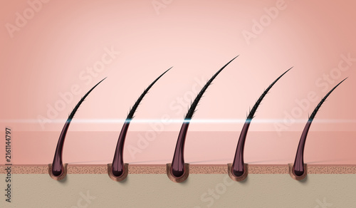 Row of multiple hair strands growing from skin scalp layer - 3d illustration