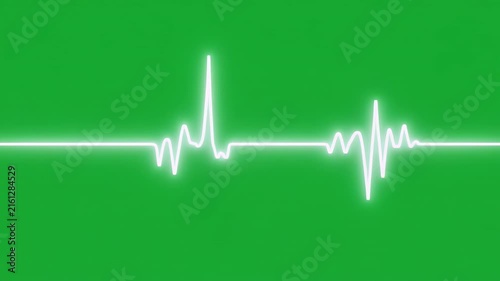 Electrocardiogram Waves on Green Screen with Black Background Seamless Loop
