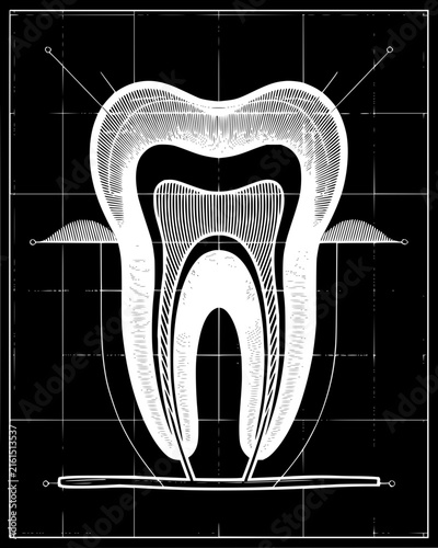 Dental anatomy cross section diagram of a tooth showing internal layers on a technical grid background
