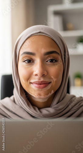 Smiling young muslim woman in hijab with vitiligo looking at camera sitting at desk behind laptop indoors