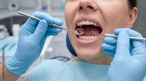 Dentist with blue gloves uses a dental mirror and probe to examine a female patient's teeth in a dental clinic