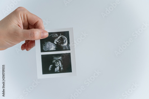 Foto Woman holding a photo of an ultrasound scan of a baby on a white background