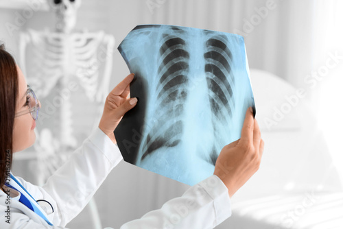 Female doctor studying x-ray image of lungs in clinic, closeup