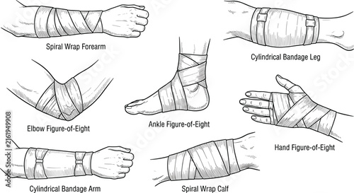 Medical first aid bandaging techniques set showing spiral wrap and figure of eight compression dressings on limbs