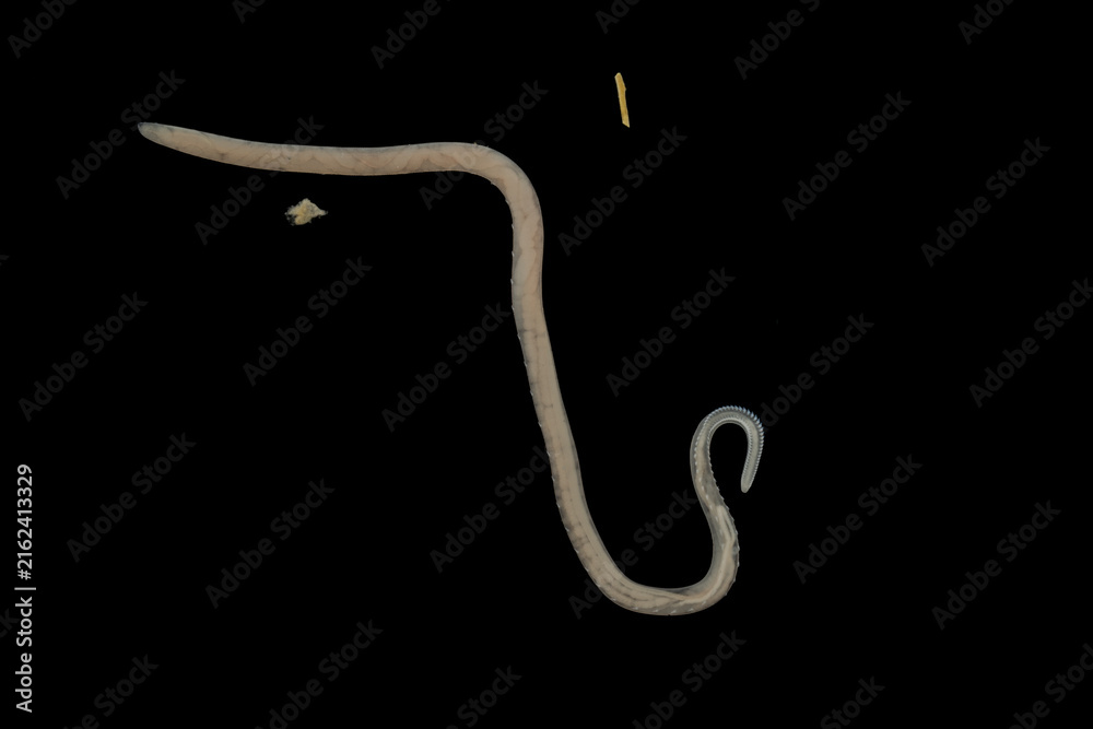 Fototapeta premium Scientific collection of freshwater trematode parasites, including Clinostomum spp., Postorchigenes sp., and Thapariella sp. These parasitic flatworms have complex life cycles involving multiple hosts
