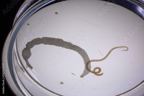 Scientific collection of freshwater trematode parasites, including Clinostomum spp., Postorchigenes sp., and Thapariella sp. These parasitic flatworms have complex life cycles involving multiple hosts