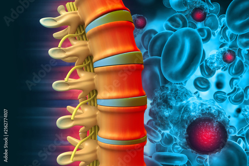 pain in the spine, pain in the back, highlighted in red. Spine cancer. 3d illustration