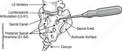 Human Sacrum Bone with Medical Instrument Illustration