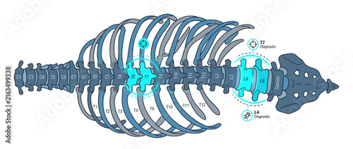 Human Spine Anatomy Illustration with Diagnostic Highlights