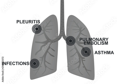 Foto Lungs pain disorders. vector illustration