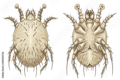 Scientific medical illustration depicting Sarcoptes scabiei with its characteristic body, legs, bristles, and microscopic features for educational purposes.