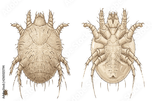 Professional biological illustration of Sarcoptes scabiei, highlighting the microscopic scabies mite structure and anatomical characteristics associated with skin infestation.