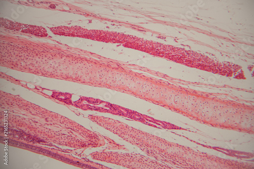 Microscopic view of human muscle tissue showing striations and cellular structures in shades of pink and purple, highlighting the intricate details of muscle fibers