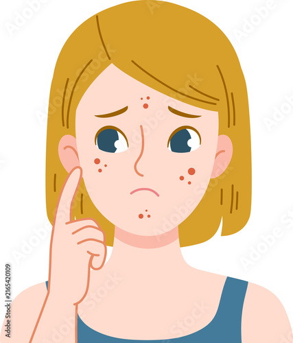 woman worried with acne problem