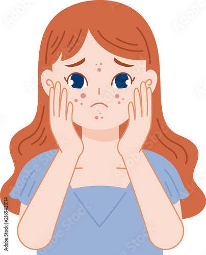 woman worried with acne problem
