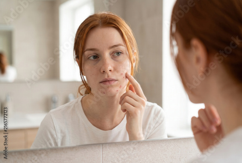 Young Woman Examining Facial Acne in Bathroom Mirror