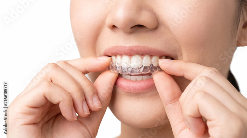 Clear Aligners Dental Correction Set. Invisalign Smile Transformation. Transparent Braces Applying On Teeth. Orthodontic Treatment Concept