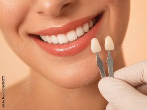 Cosmetic Dental Samples and Natural Smile