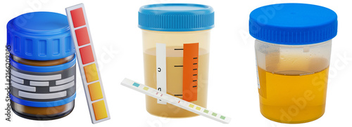 Obraz na plátně Three urine sample cups with blue lids and urine test strips, isolated on white background
