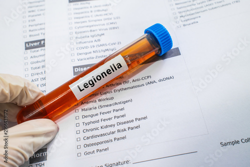 blood sample in lab test tube for Legionella test