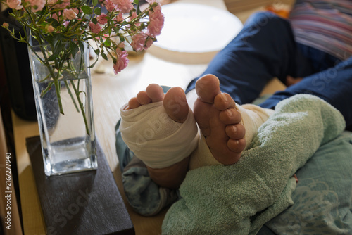 A person with bandaged feet rests on a surface next to a vase of pink flowers.
